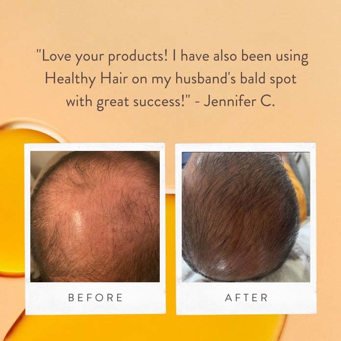 Healthy Hair Review – Jennifer C. – 2