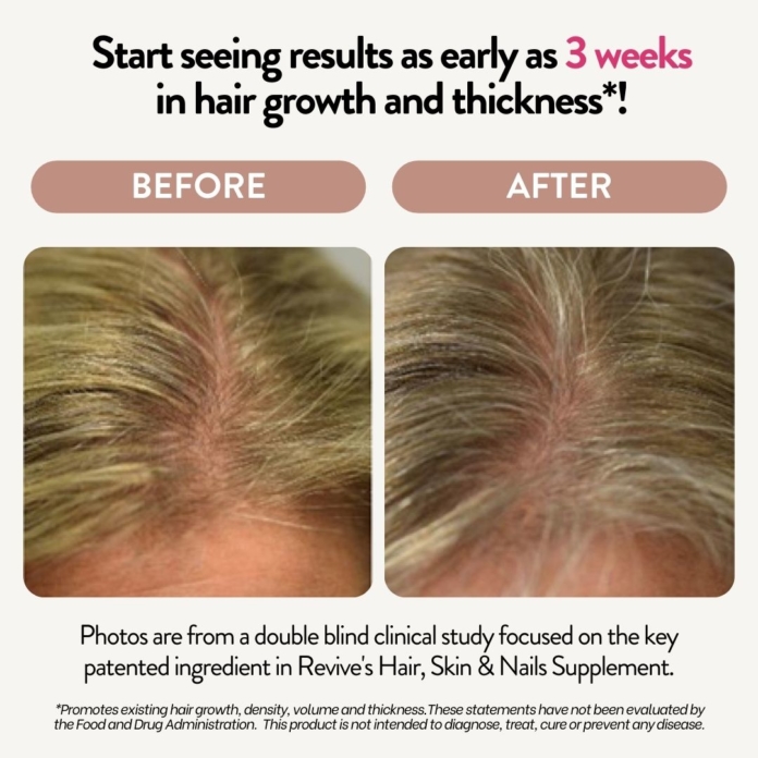 Hair Skin and Nails Supplement before after results